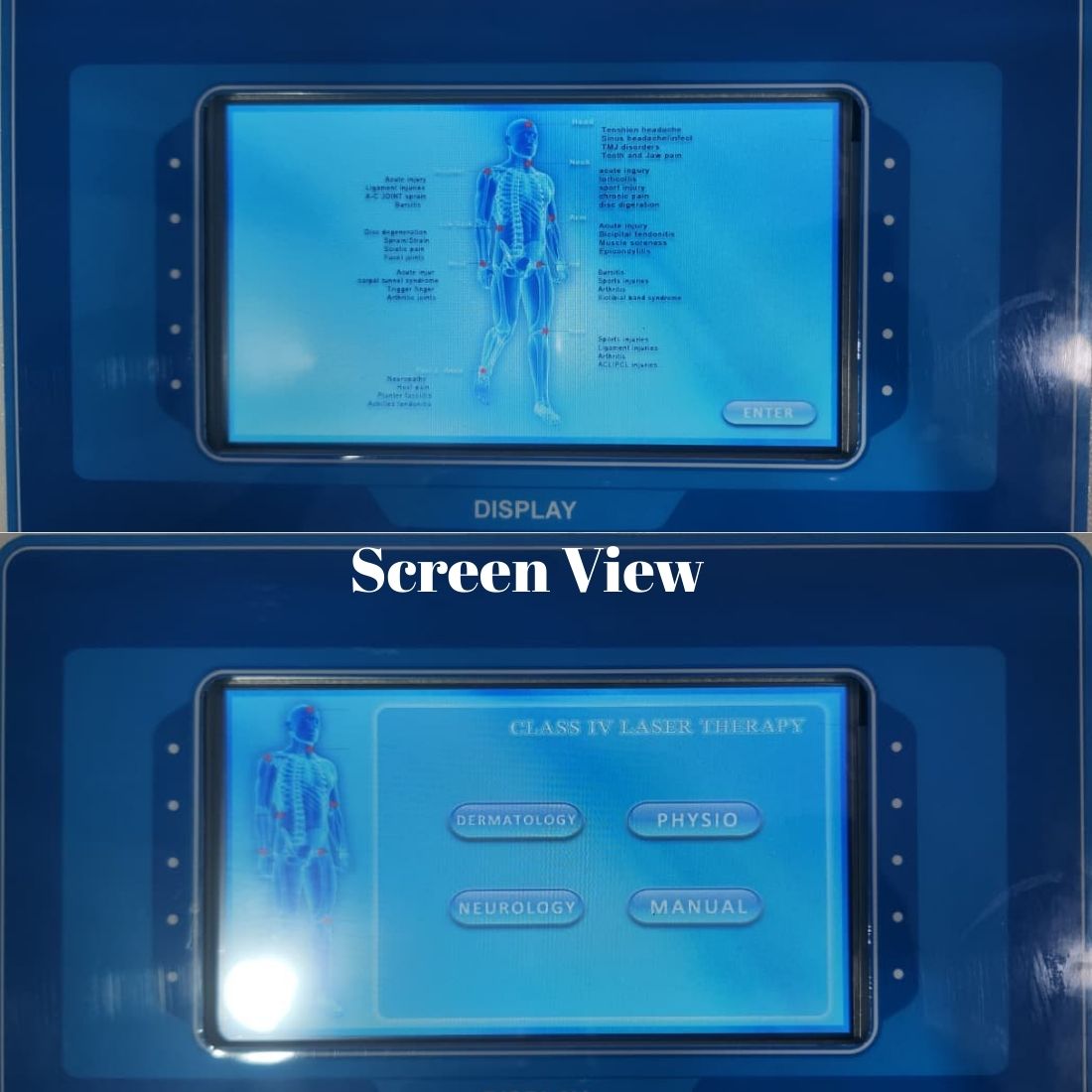 acco Physiotherapy Laser Therapy Unit Class 3 500Mw (Touch Screen) with 2 Probes