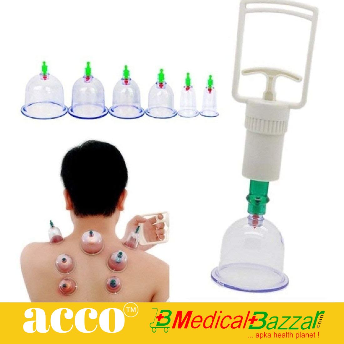 Hijama Vacuum Cupping Set