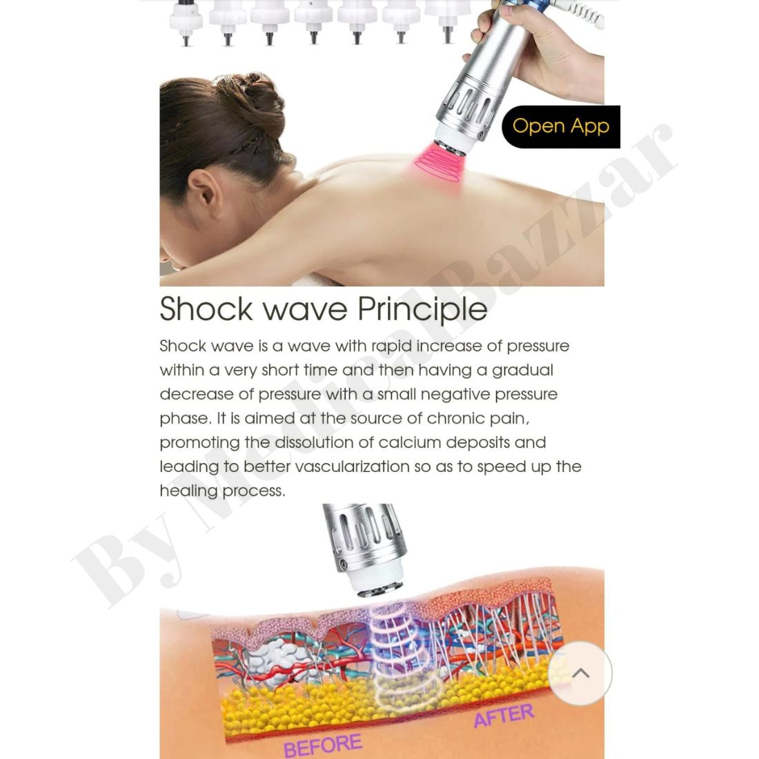 acco Shockwave Therapy Machine (Table Model)