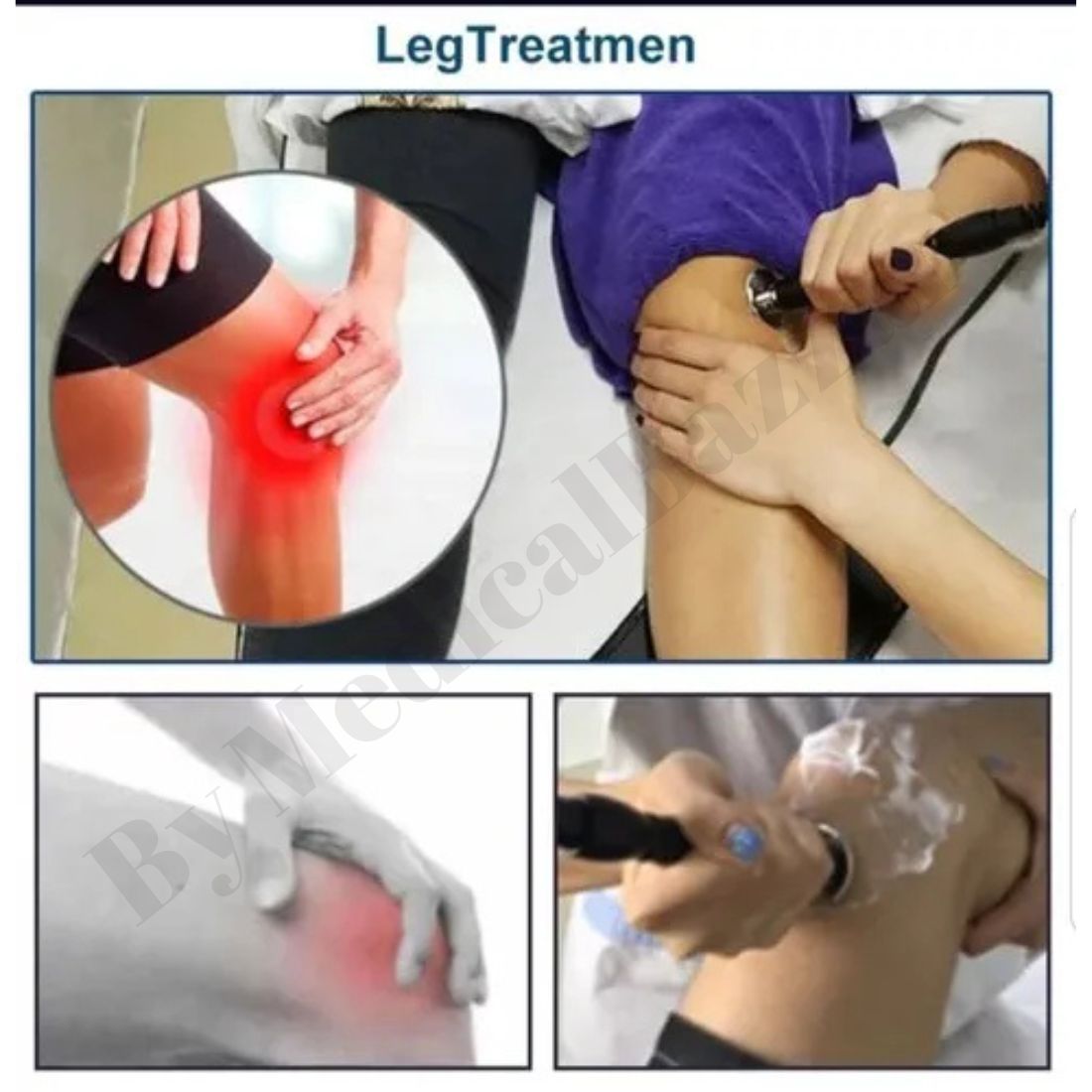 Smart Tecar Therapy Machine for Pain relief
