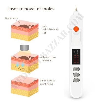 Plasma Pen for Skin Care & Mole Removal