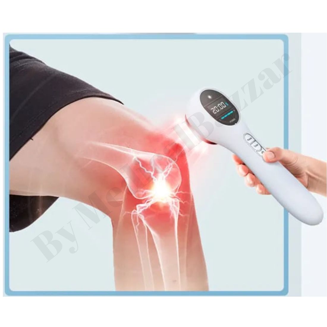 Portable Laser Therapy Machine (808nm)