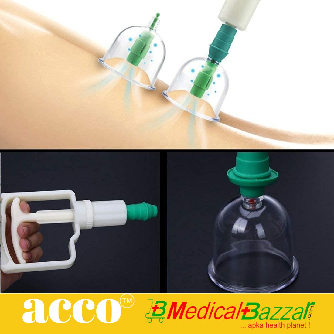 Hijama Vacuum Cupping Set