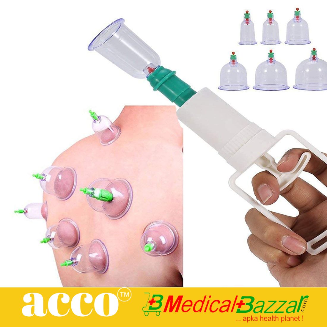 Hijama Vacuum Cupping Set