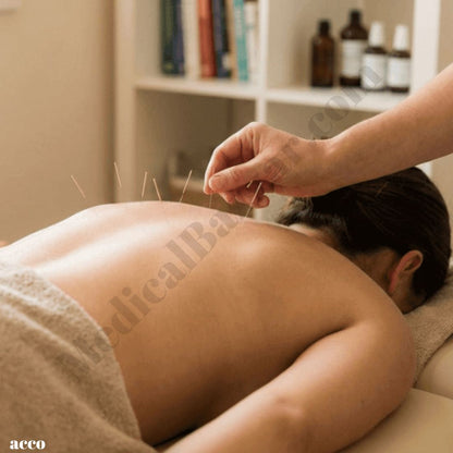 Dry Needles- Acupuncture Needles