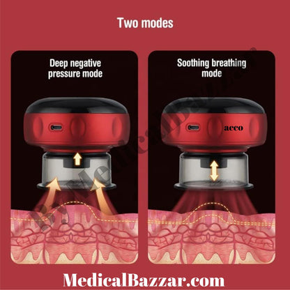 Electric Vacuum Cupping Therapy Set 6 Gear