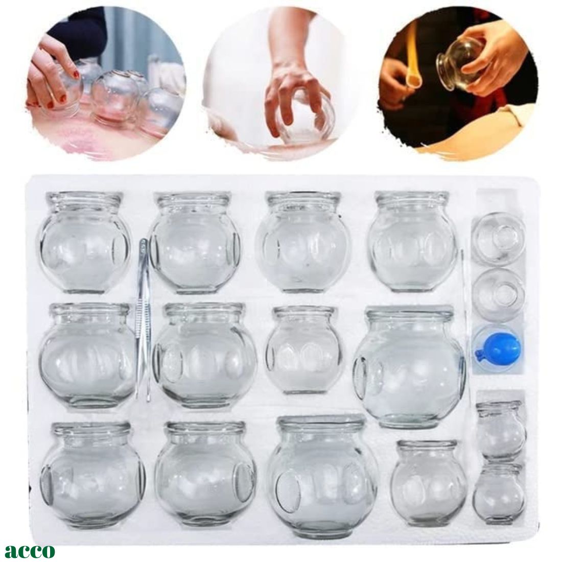 acco Glass Fire Cupping Set of 16 Cups
